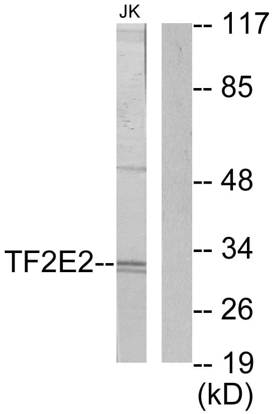 GTF2E2 Antibody (aa151-200)