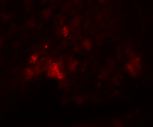 CD274 / B7-H1 / PD-L1 Antibody