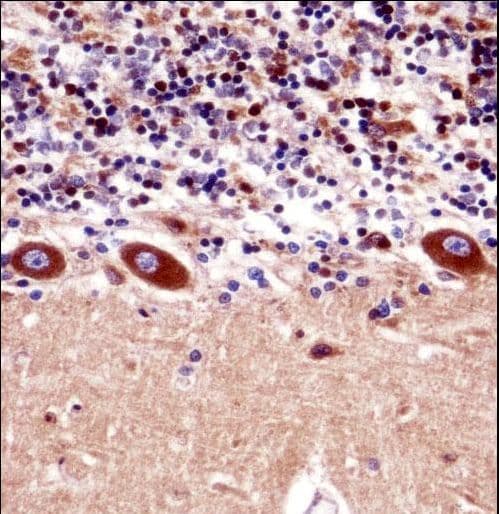 Polyclonal Rabbit anti-Human KCNA1 / Kv1.1 Antibody (aa172-201, IHC, WB)