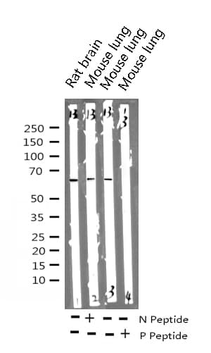 PXN / Paxillin Antibody (phospho-Tyr118)