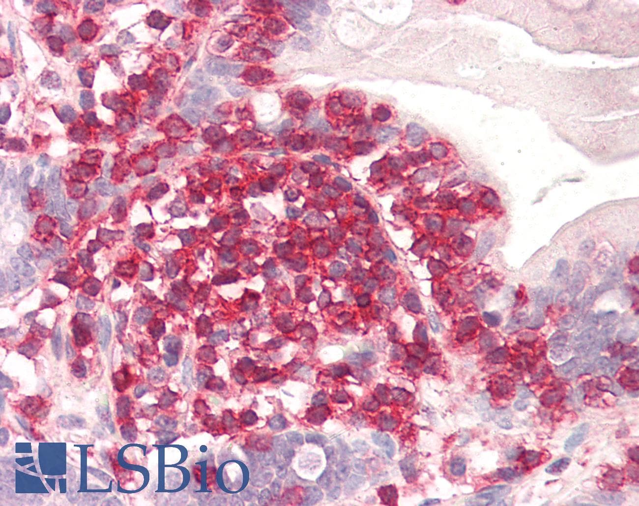PathPlus™ Polyclonal Goat anti-Human CORO1A / Coronin 1a Antibody (aa546-558, IHC, WB)