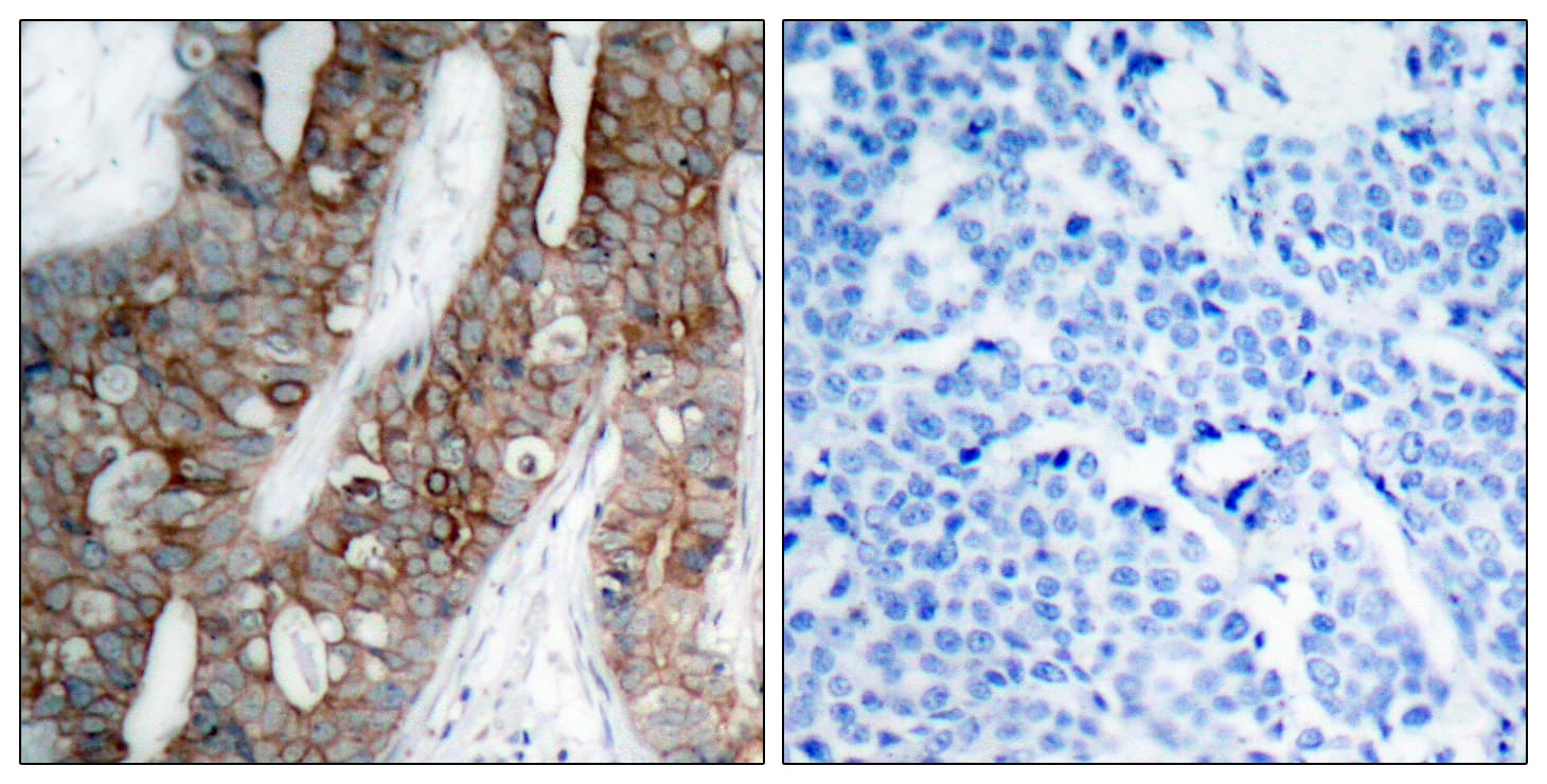 ITGB3 / Integrin Beta 3 / CD61 Antibody (aa731-780)