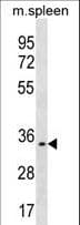 TREML1 / TLT1 Antibody (aa215-241)