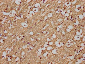 APP / Beta Amyloid Precursor Antibody (clone 5A11E5)