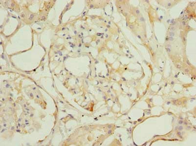 ROGDI Antibody