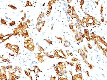 HSPB1 / HSP27 Antibody (clone SPM252)