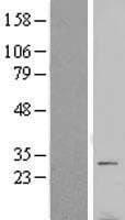 VTI1B Protein (Over-Expression Lysate Myc-DDK (Flag))