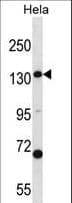 CPS1 Antibody (aa262-291)