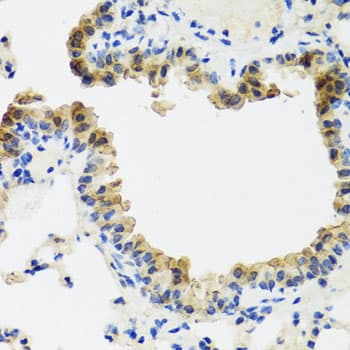 Polyclonal Rabbit anti-Human ST6GAL1 / CD75 Antibody (IHC, WB)