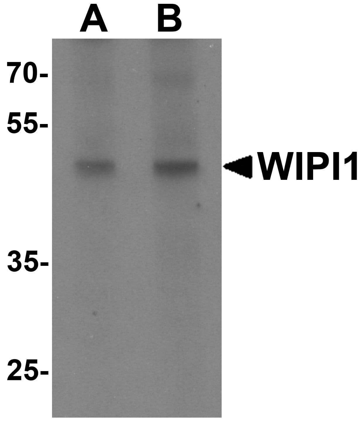 IHC-plus™ ATG18 / WIPI1 Antibody