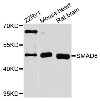 Polyclonal Rabbit anti-Human SMAD6 Antibody (WB)