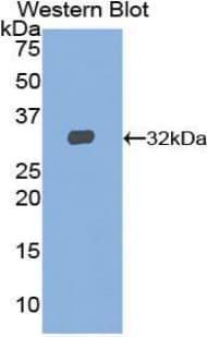 STAT2 Antibody (aa658-912)