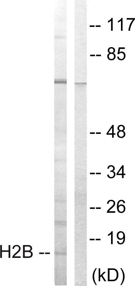 HIST1H2BB Antibody (p14)