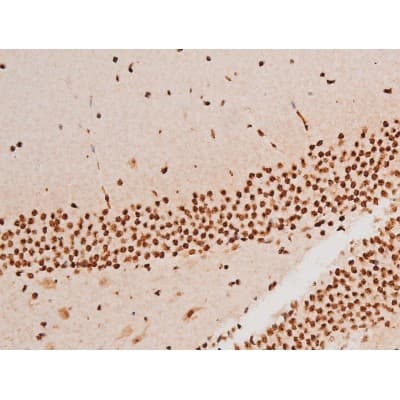 Polyclonal Rabbit anti-Human SYK Antibody (phospho-Tyr348, IHC, IF, WB)