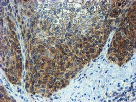 PPAT Antibody (aa42-278, clone OTI1B8)