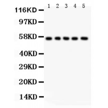 ABI1 / SSH3BP1 Antibody (aa151-175)