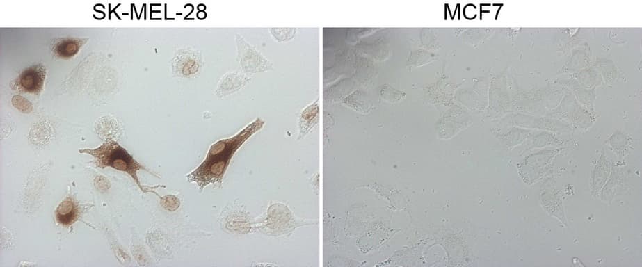 MLANA / Melan-A Antibody (aa48-118, clone OTI2E7)