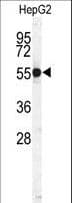 CTSH / Cathepsin H Antibody (aa25-54)