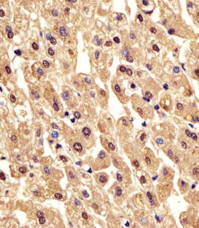 Polyclonal Rabbit anti-Human PGM1 / Phosphoglucomutase 1 Antibody (aa469-501, IHC, WB)