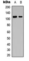 NFAT4 / NFATC3 Antibody (phospho-Ser165)