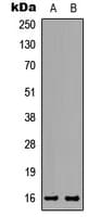 TP-2 / TNP2 Antibody (C-Terminus)