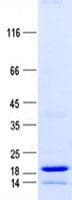 Human TXNL4B Protein (Recombinant His, N-Terminal)