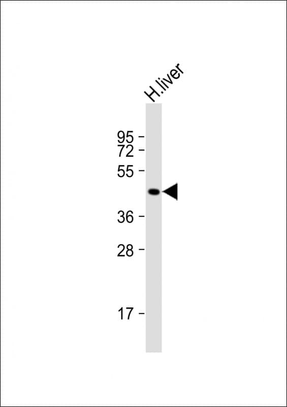 GCNT2 Antibody (Internal)