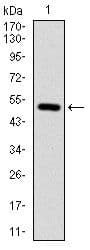 Monoclonal Mouse anti-Human ITGB1 / Integrin Beta 1 / CD29 Antibody (clone 3B6, IHC, WB)
