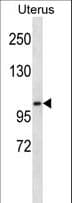 KSR2 Antibody (aa808-836)