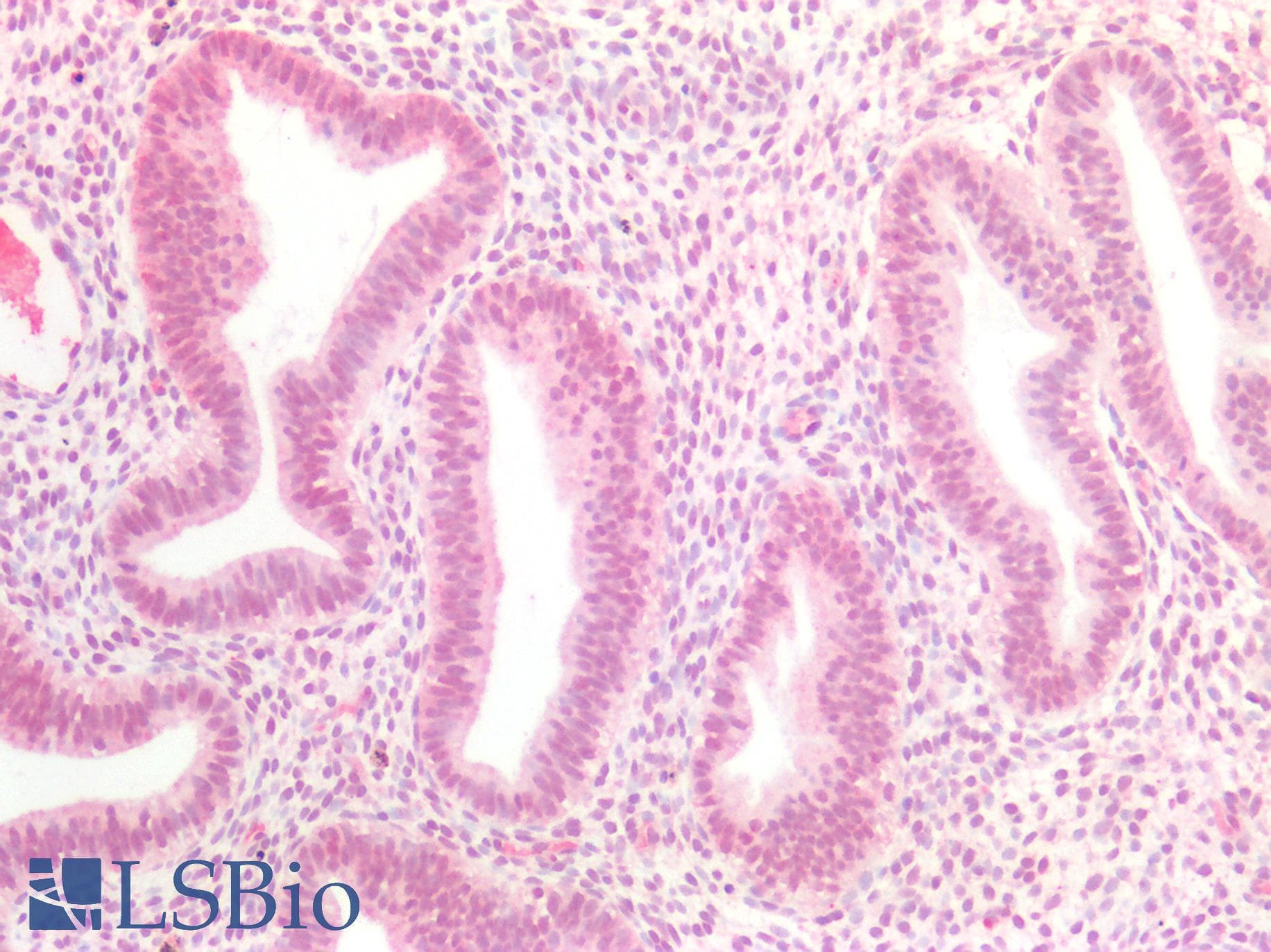 PathPlus™ MEN1 / Menin Antibody (aa575-C-term)
