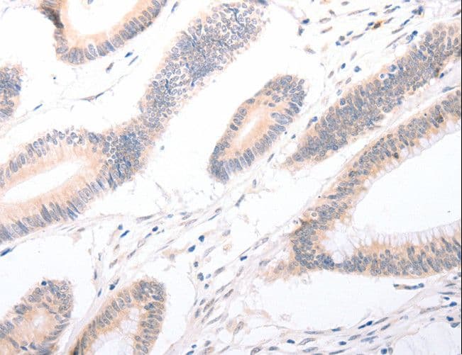 Polyclonal Rabbit anti-Human CELSR2 Antibody (IHC)