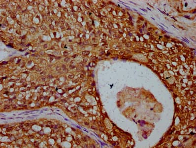 Polyclonal Rabbit anti-Human TBCD Antibody (IHC, IF)