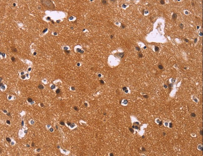 CBX3 / HP1 Gamma Antibody