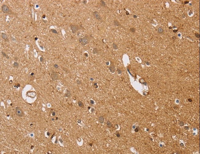 Polyclonal Rabbit anti-Human ITPR1 / IP3 Receptor Type 1 Antibody (IHC)
