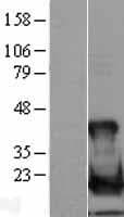UBE2L6 Protein (Over-Expression Lysate Myc-DDK (Flag))