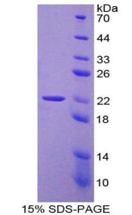 Mouse EGFR Protein (Recombinant His-T7)