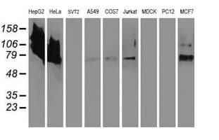 IHC-plus™ MAC-2-BP / LGALS3BP Antibody (clone 5E3)