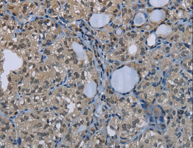 GYS1 / Glycogen Synthase Antibody