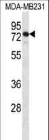Polyclonal Rabbit anti-Human SLFN12 Antibody (aa192-220, WB)