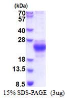 Human CHAC2 Protein (Recombinant His)