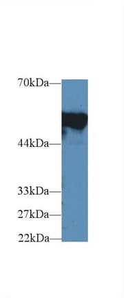FGB / Fibrinogen Beta Chain Antibody (aa35-481, Cy3)