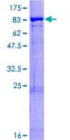 Human PTGS2 / COX2 / COX-2 Protein (Recombinant GST)