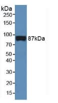 CD144 / CDH5 / VE Cadherin Antibody (aa59-382)