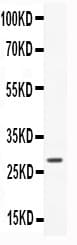CNTF Antibody (aa2-200)