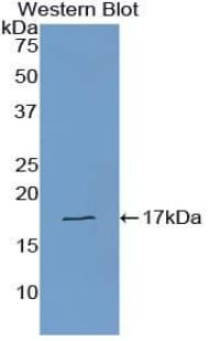 TTR / Transthyretin Antibody (aa21-147, FITC)
