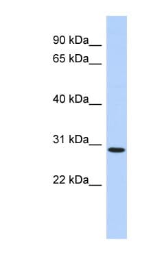 SERTAD2 Antibody (aa35-84)