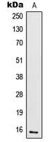 IL2 Antibody (Internal)