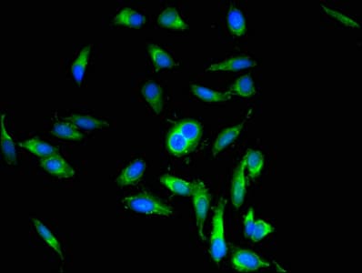 Polyclonal Rabbit anti-Human POSTN / Periostin Antibody (IHC, WB)