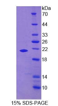 Human GAS6 Protein (Recombinant)