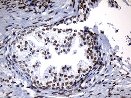 Monoclonal Mouse anti-Human ZNF705D Antibody (clone OTI1G1, IHC, WB)
